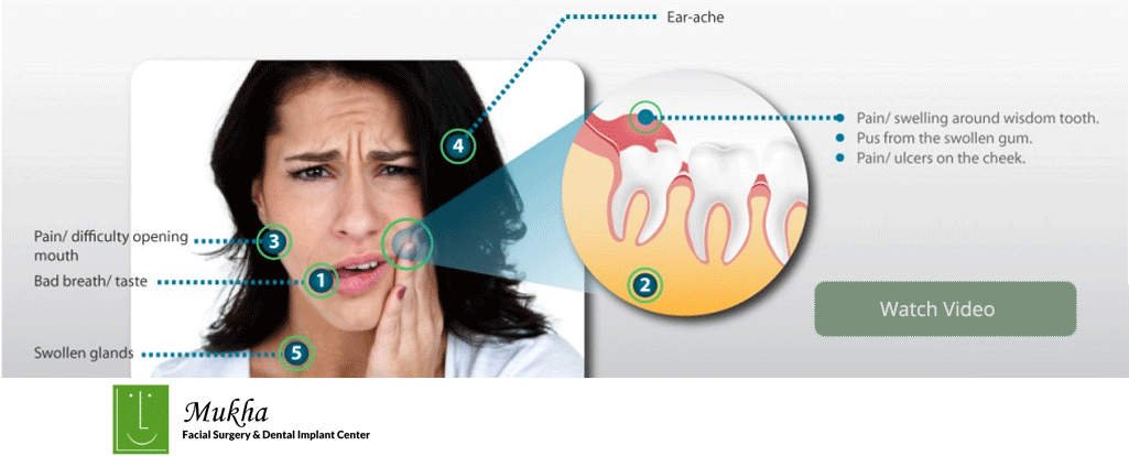 Wisdom tooth pain and infection
