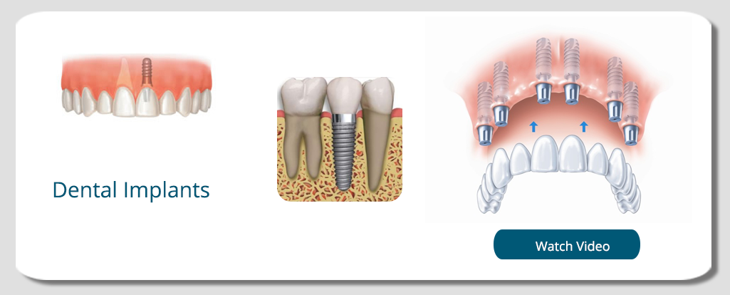 Wisdom tooth pain and infection